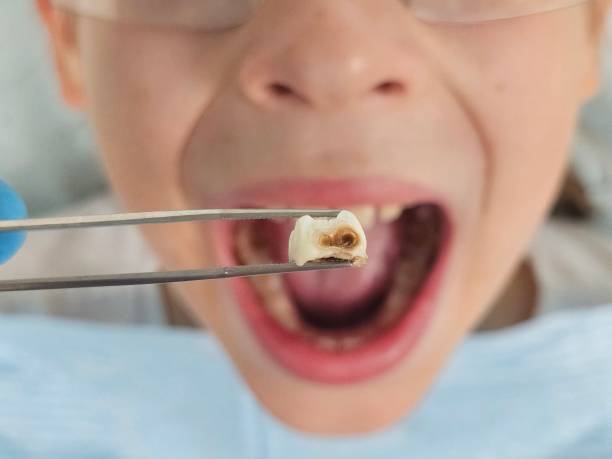 Best Weekend Emergency Dental Services in Patrick Springs, VA